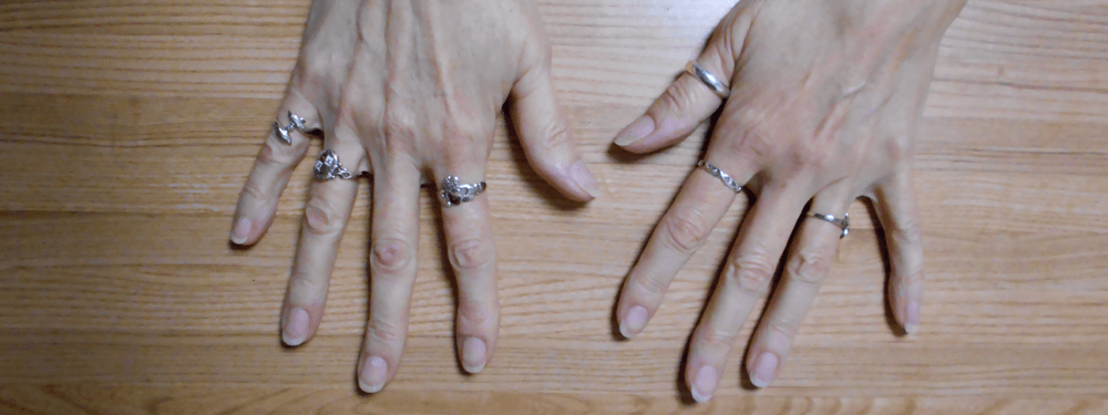 a picture of my hands showing nail growth