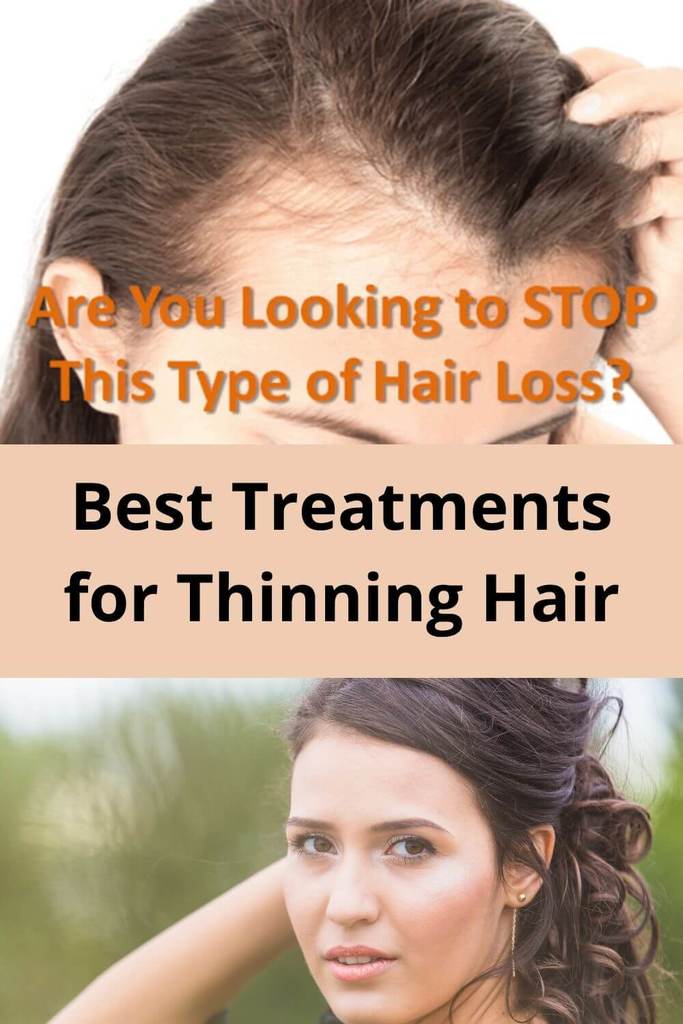 Best Treatments for Thinning Hair - Trish's treasure trove of ...