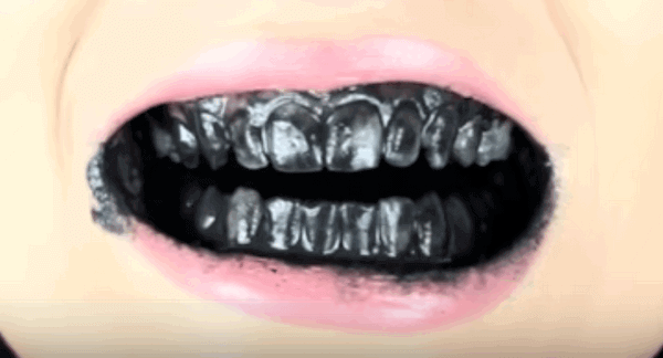closeup of a mouth that has used charcoal toothpaste